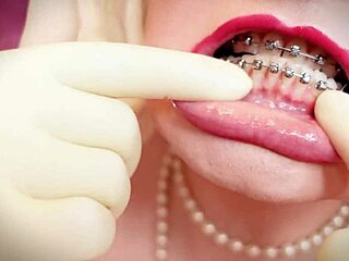 asmr video with milf in double layer gloves showing braces