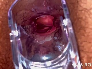 seeing that mature bbw take it deep in hairy anal with speculum