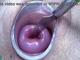 Prolapsed cervix lesbians feel intense pain and pleasure in extreme session