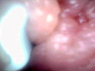 endoscope camera shows the most sensitive parts of the penis in this educational video