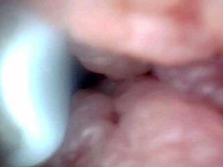 endoscope camera shows the most sensitive parts of the penis in this educational video