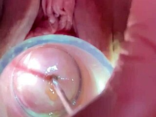 Medical exploration of deep cervix with Hegar sounds