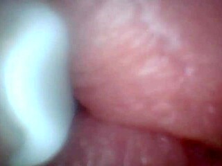 endoscope camera shows the most sensitive parts of the penis in this educational video