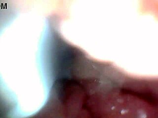 endoscope camera shows the most sensitive parts of the penis in this educational video