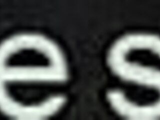 redhead patient shoves fist deep in big ass nurse's anal during bizarre hospital lezdom session