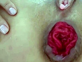 Destroyed juicy prolapse asshole in extreme close-up anal play!