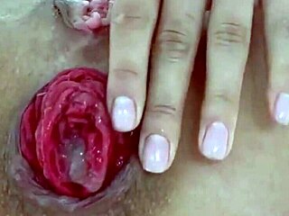 Destroyed juicy prolapse asshole in extreme close-up anal play!