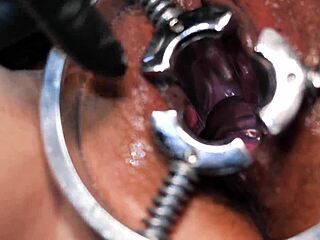 Lady soniac gets fisted with medieval speculum until she reaches orgasm